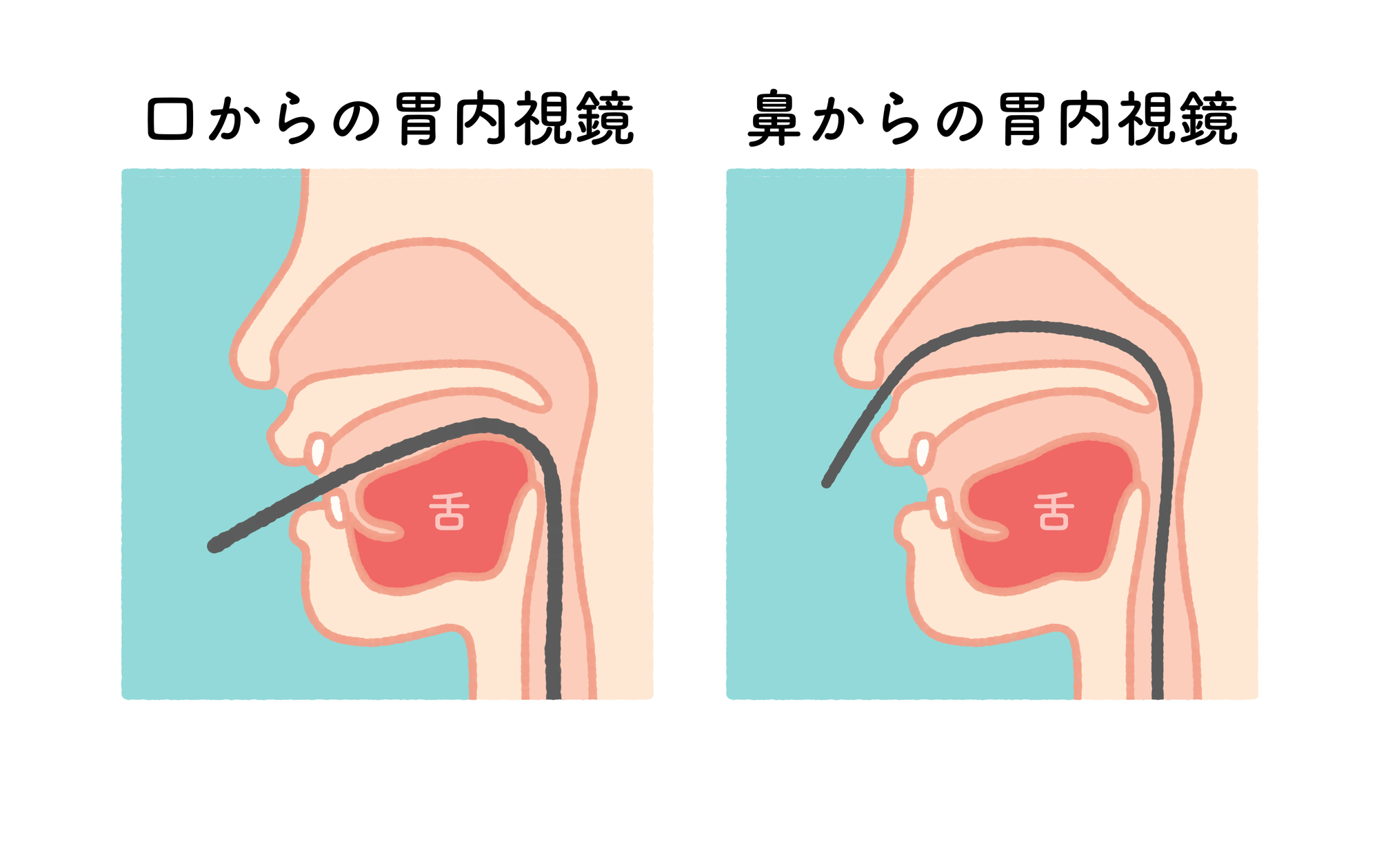 経口・経鼻内視鏡検査のどちらも選択可能な検査